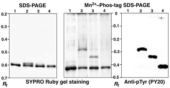 tau Tyr kinase Mn 2008